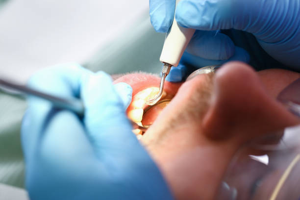 Best Dentist for Tooth Abscess  in Vassar College, NY