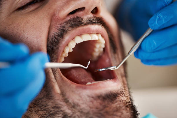 Best Chipped Tooth Repair Near Me  in Vassar College, NY