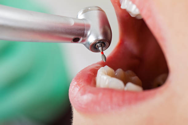 Best Urgent Tooth Repair  in Vassar College, NY